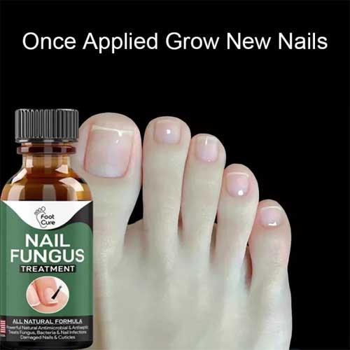 Nail Fungus Treatment – 10ml - Image 2
